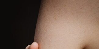 5 tipů, jak přestat mít ostych v plavkách 5 tipů, jak přestat mít ostych v plavkách