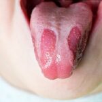 Přírodní probiotika: Osminásobný zdroj v potravinách Přírodní probiotika: Osminásobný zdroj v potravinách