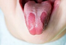 Přírodní probiotika: Osminásobný zdroj v potravinách Přírodní probiotika: Osminásobný zdroj v potravinách