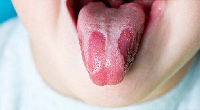 Přírodní probiotika: Osminásobný zdroj v potravinách Přírodní probiotika: Osminásobný zdroj v potravinách